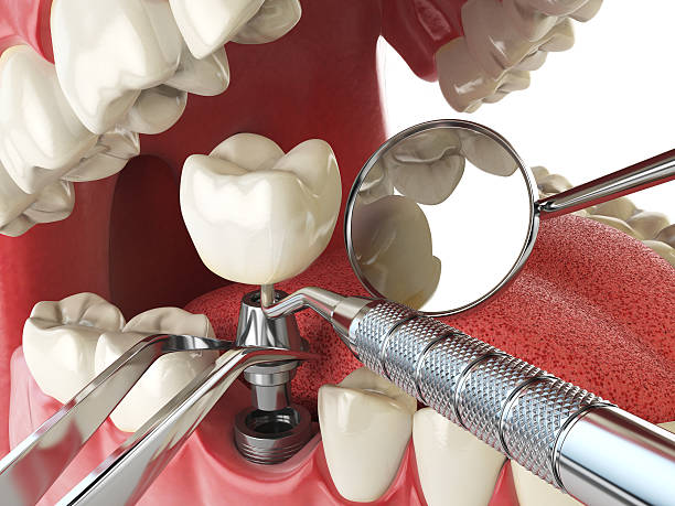 Best Pediatric Emergency Dentist in Schererville, IN